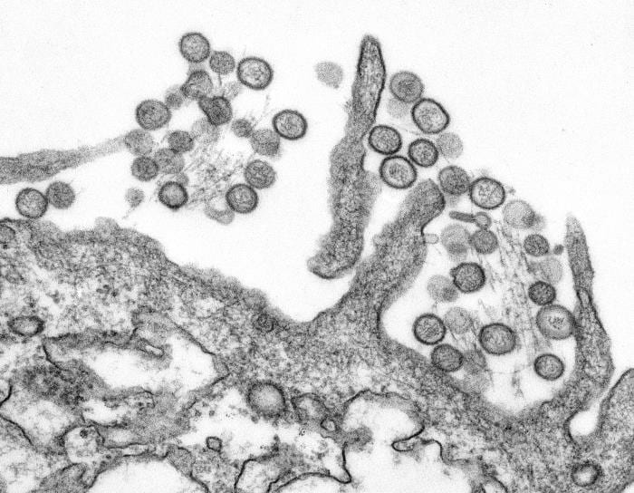 Black-and-white transmission electron micrograph showing spherical hantavirus particles.